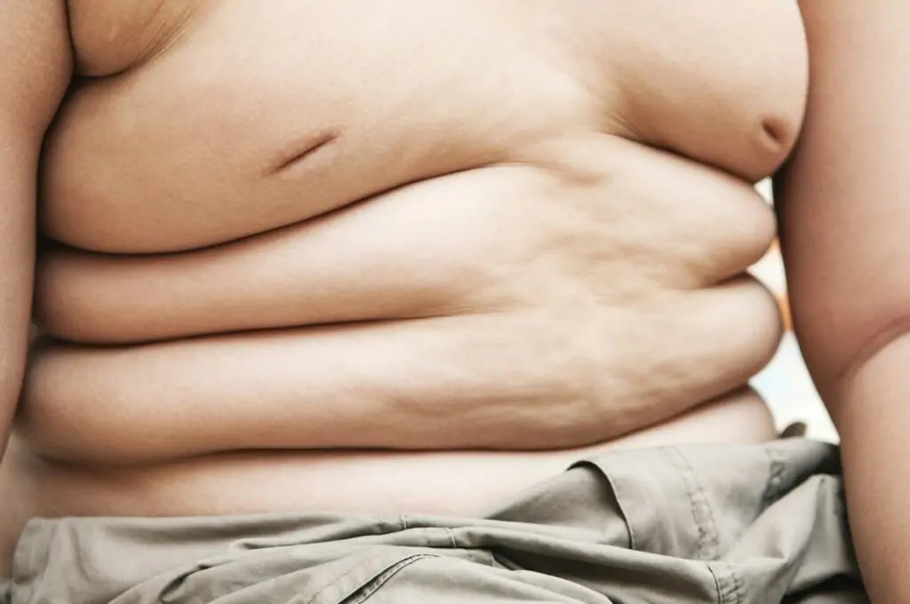 Closeup torso of an obese kid