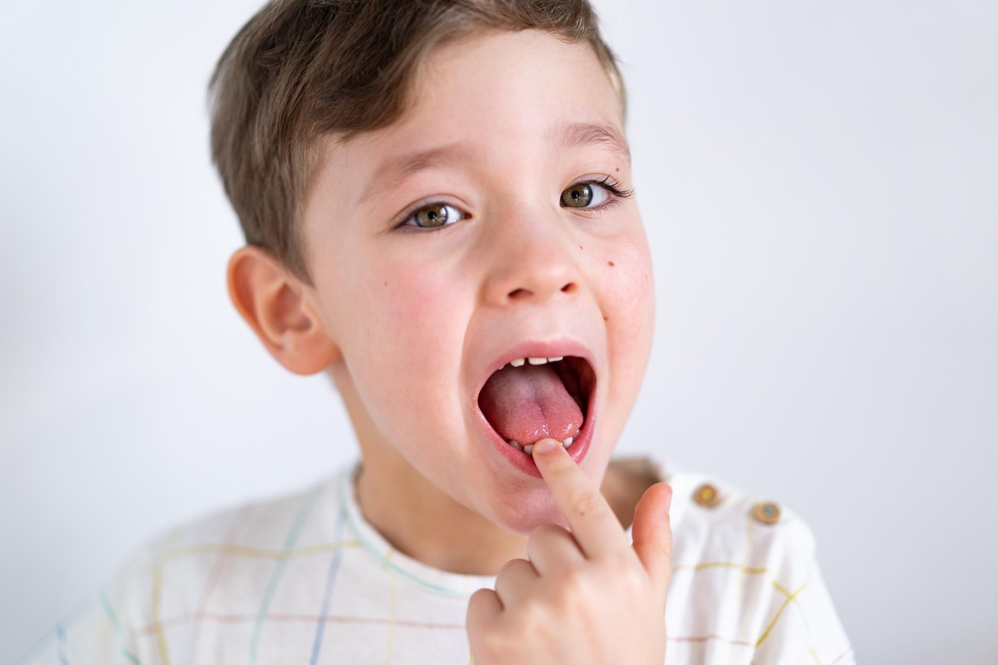 Cute boy pulling loose tooth. Process of removing a baby tooth.