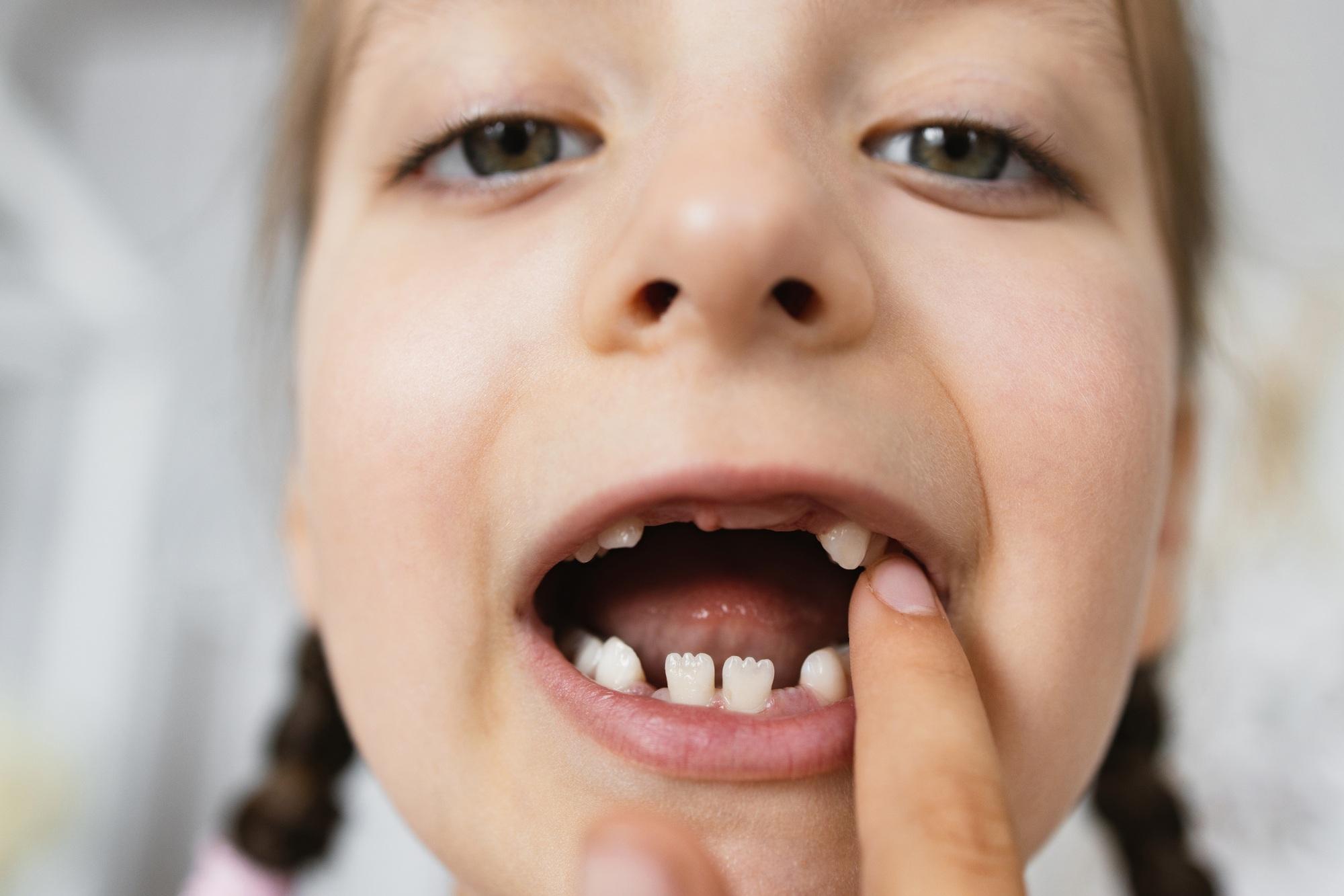 Portrait of a little girl with missing baby teeth at home