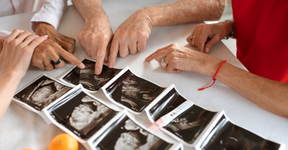 découvrez tout ce que vous devez savoir sur le rythme cardiaque fœtal, son importance pour la santé de votre bébé, et comment il est mesuré lors des échographies et des visites prénatales.