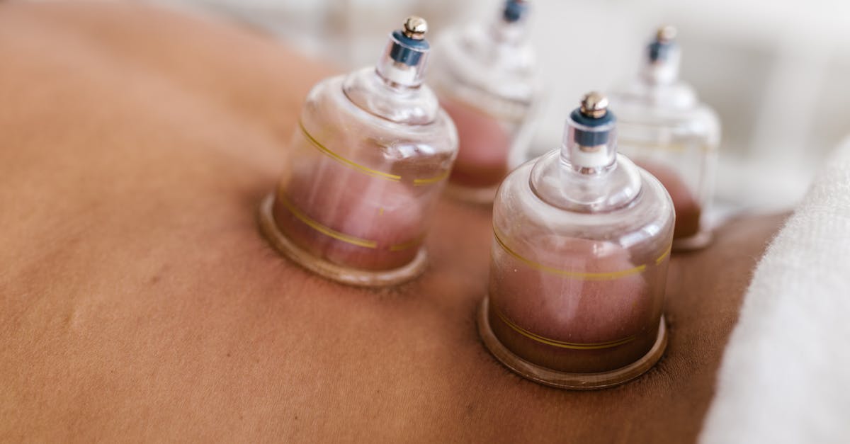 découvrez les bienfaits de l'acupuncture, une pratique millénaire de la médecine traditionnelle chinoise qui utilise des aiguilles pour stimuler des points spécifiques du corps, soulager la douleur et améliorer le bien-être général.