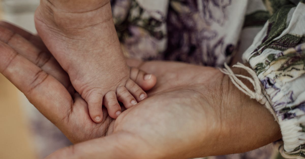 découvrez des solutions et conseils pour les problèmes de peau courants chez les bébés. informez-vous sur les irritations, les éruptions cutanées et les soins adaptés pour apaiser la peau délicate de votre enfant.