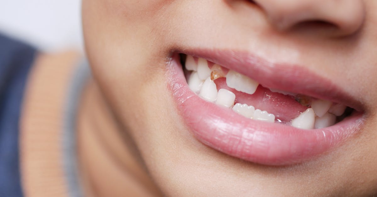 découvrez des conseils essentiels pour le soin dentaire des tout-petits : l'importance de l'hygiène bucco-dentaire, des méthodes adaptées pour un brossage efficace et des astuces pour prévenir les caries. assurez un sourire radieux à votre enfant dès ses premières dents !