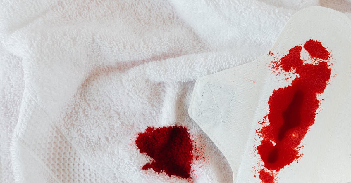 découvrez les causes, les symptômes et les solutions pour les irrégularités menstruelles. préservez votre santé reproductive et apprenez à mieux comprendre votre cycle.
