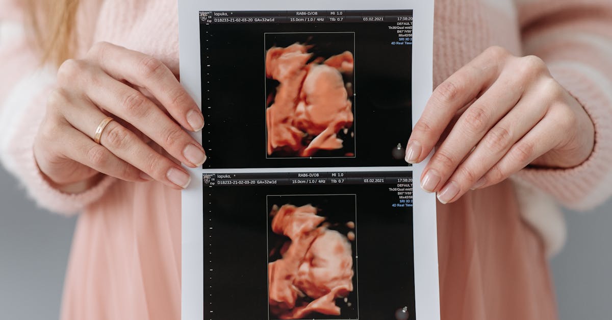 découvrez les nombreux avantages de l'échographie, une technique d'imagerie médicale sûre et non invasive. apprenez comment elle facilite le diagnostic, améliore le suivi des traitements et assure des grossesses en toute sérénité.