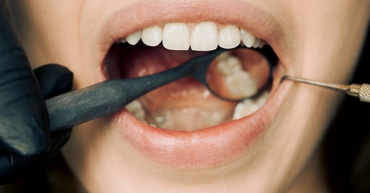 découvrez tout sur la plaque dentaire : ses causes, ses effets sur la santé bucco-dentaire et les meilleures astuces pour la prévenir et l'éliminer efficacement.