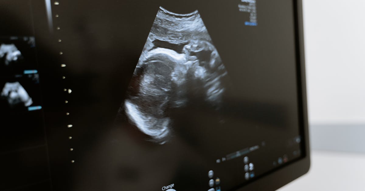 découvrez tout ce que vous devez savoir sur le fœtus : son développement, son importance durant la grossesse et les étapes clés de sa croissance jusqu'à la naissance.