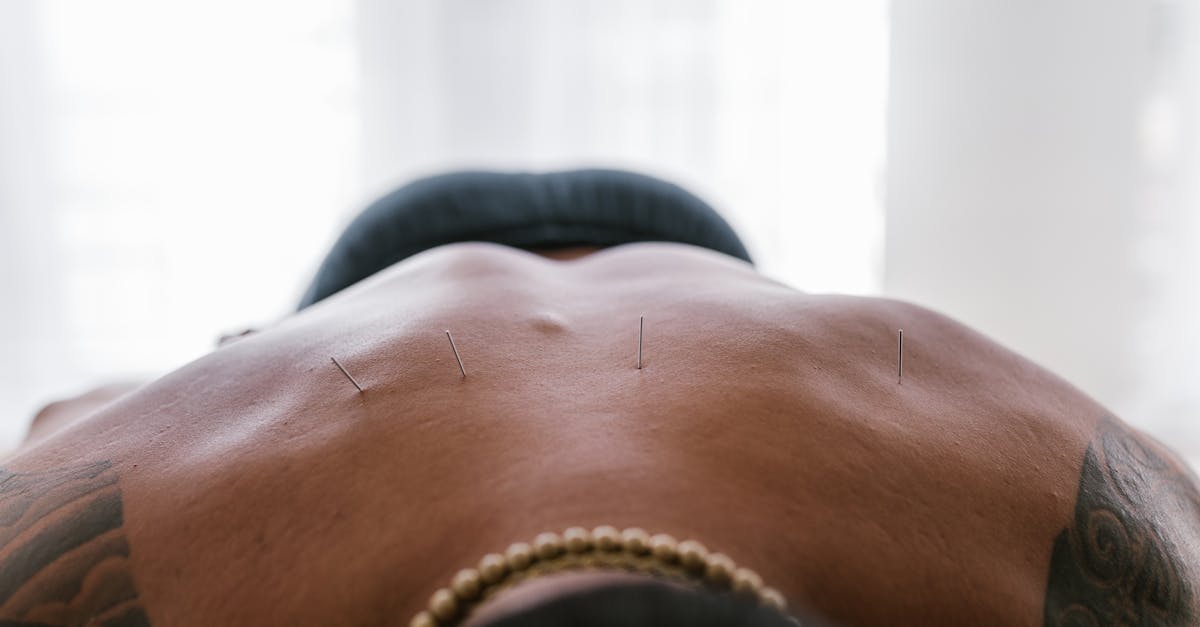 découvrez les bienfaits de l'acupuncture, une médecine traditionnelle millénaire qui soulage le stress, atténue les douleurs et favorise le bien-être. explorez ses techniques, ses applications et retrouvez l'harmonie dans votre vie quotidienne.
