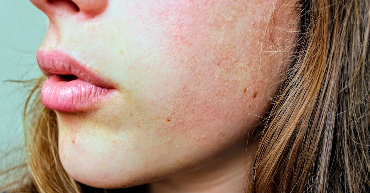 découvrez nos conseils et remèdes pour apaiser et hydrater vos lèvres gercées. apprenez à prévenir les gerçures et à maintenir des lèvres douces et saines tout au long de l'année.