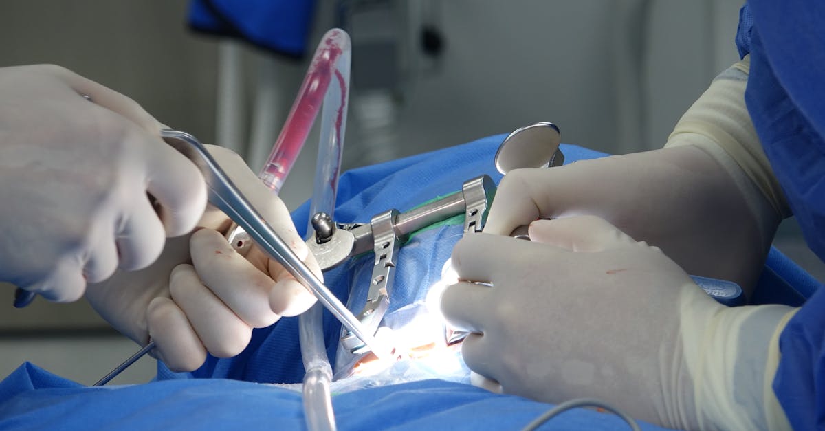 découvrez tout ce qu'il faut savoir sur l'épidurale : ses avantages, son fonctionnement, ainsi que les conseils pour bien gérer votre accouchement. informez-vous sur cette technique qui soulage la douleur pendant le travail.