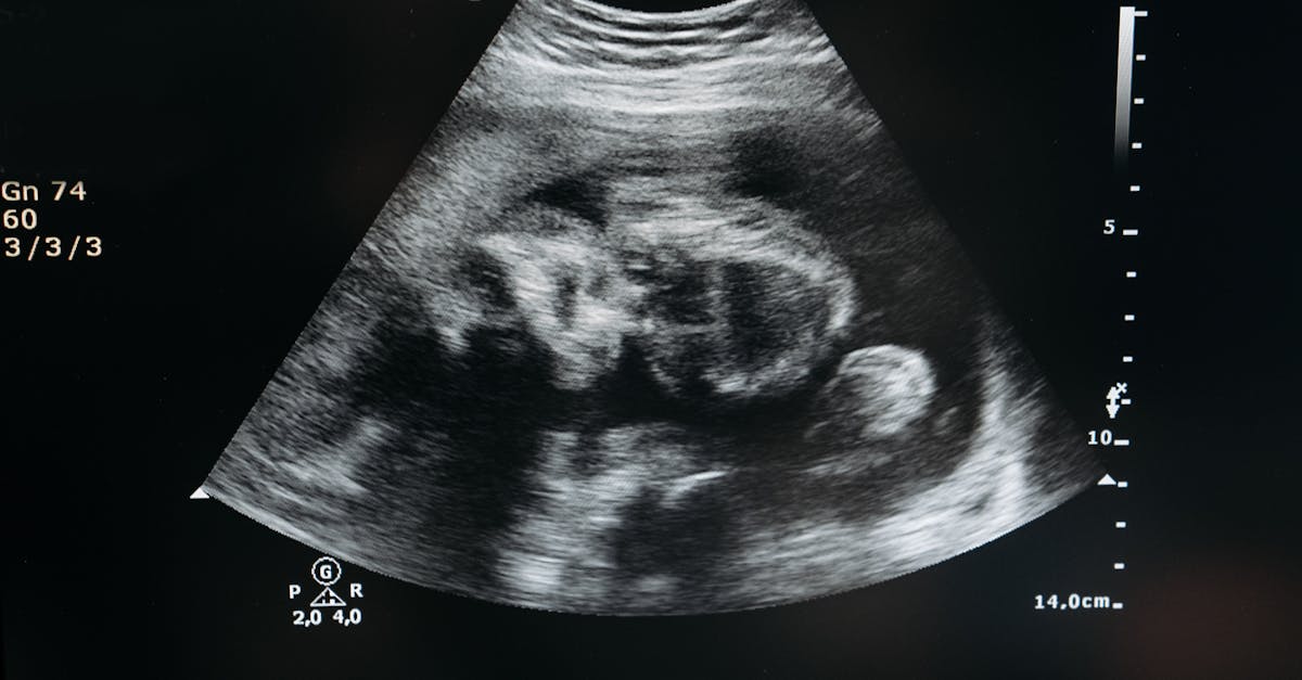 découvrez le fascinant processus du développement fœtal, de la conception à la naissance. explorez les étapes clés, les changements physiologiques et les facteurs influençant la croissance du fœtus dans le ventre maternel.