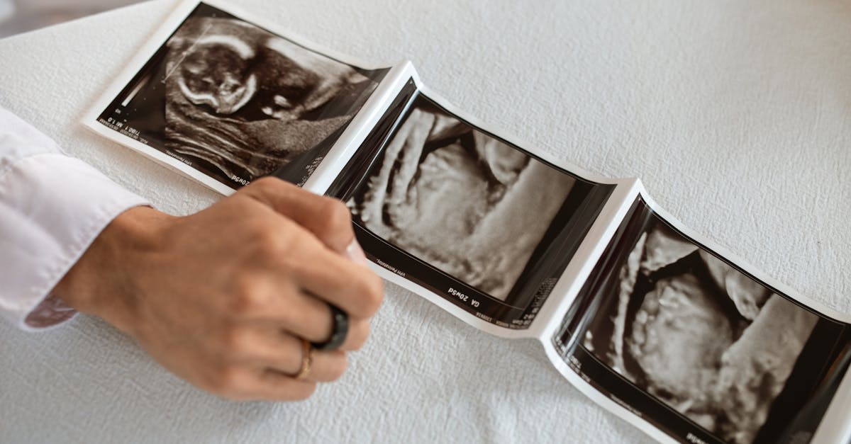 découvrez les étapes fascinantes du développement fœtal, de la conception à la naissance, et comprenez comment s'épanouissent les organes et systèmes vitaux d'un être humain en devenir.