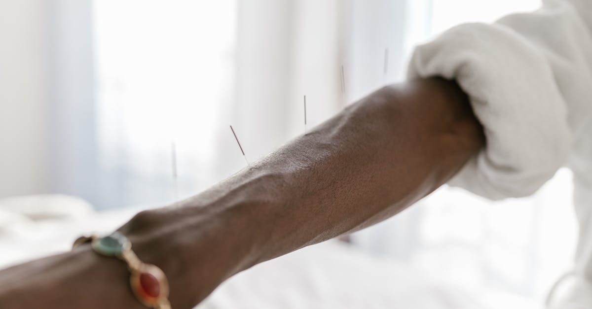 découvrez les bienfaits de l'acupuncture, une pratique ancestrale de la médecine traditionnelle chinoise qui soulage douleurs et stress. apprenez comment cette technique favorise l'harmonie du corps et de l'esprit, et explorez ses applications pour améliorer votre bien-être général.