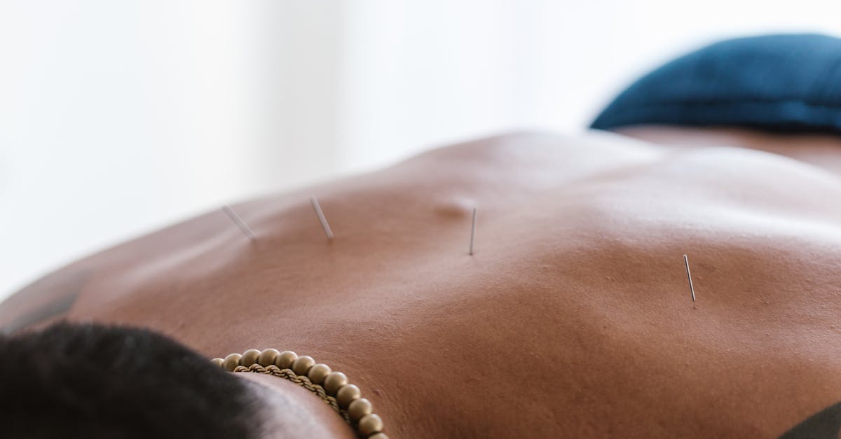 découvrez les bienfaits de l'acupuncture, une pratique millénaire qui harmonise le corps et l'esprit. soulagez le stress, les douleurs chroniques et améliorez votre bien-être général grâce à cette méthode naturelle.