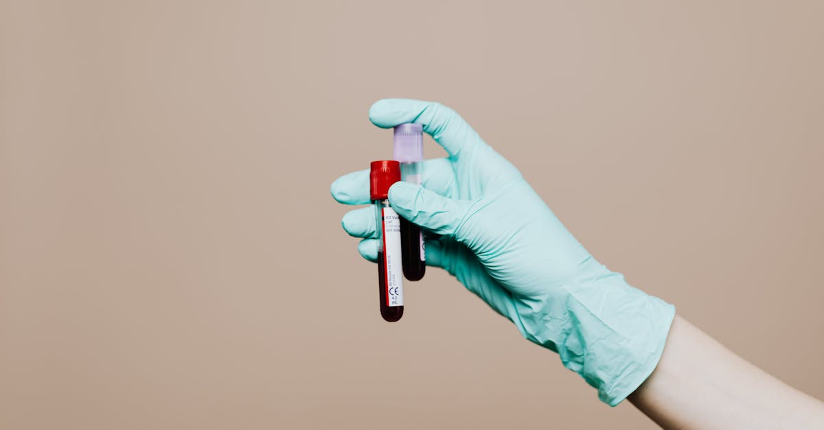 découvrez le test d'apgar, un outil essentiel pour évaluer rapidement la santé des nouveau-nés. apprenez-en davantage sur ses critères, son importance et son rôle dans les soins de maternité.
