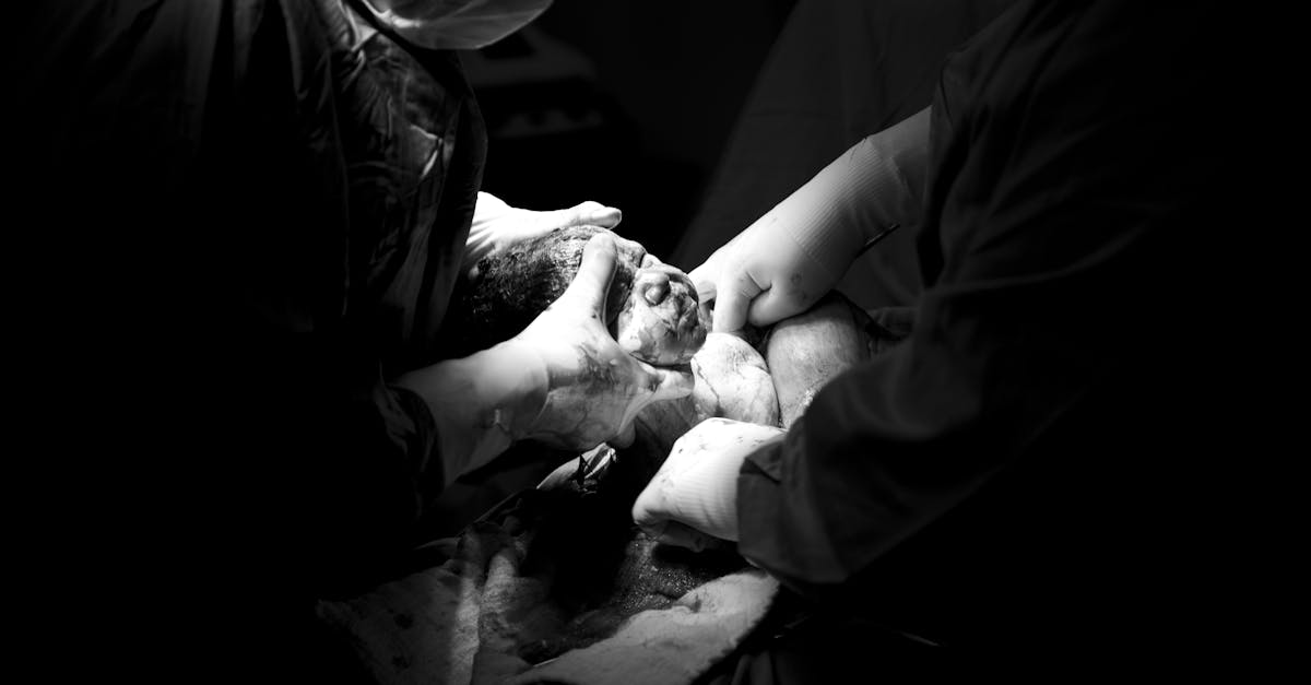 découvrez tout ce que vous devez savoir sur la césarienne : de la procédure à la récupération, en passant par les avantages et les risques. informez-vous sur cette intervention chirurgicale qui peut être essentielle pour la santé de la mère et de l'enfant.