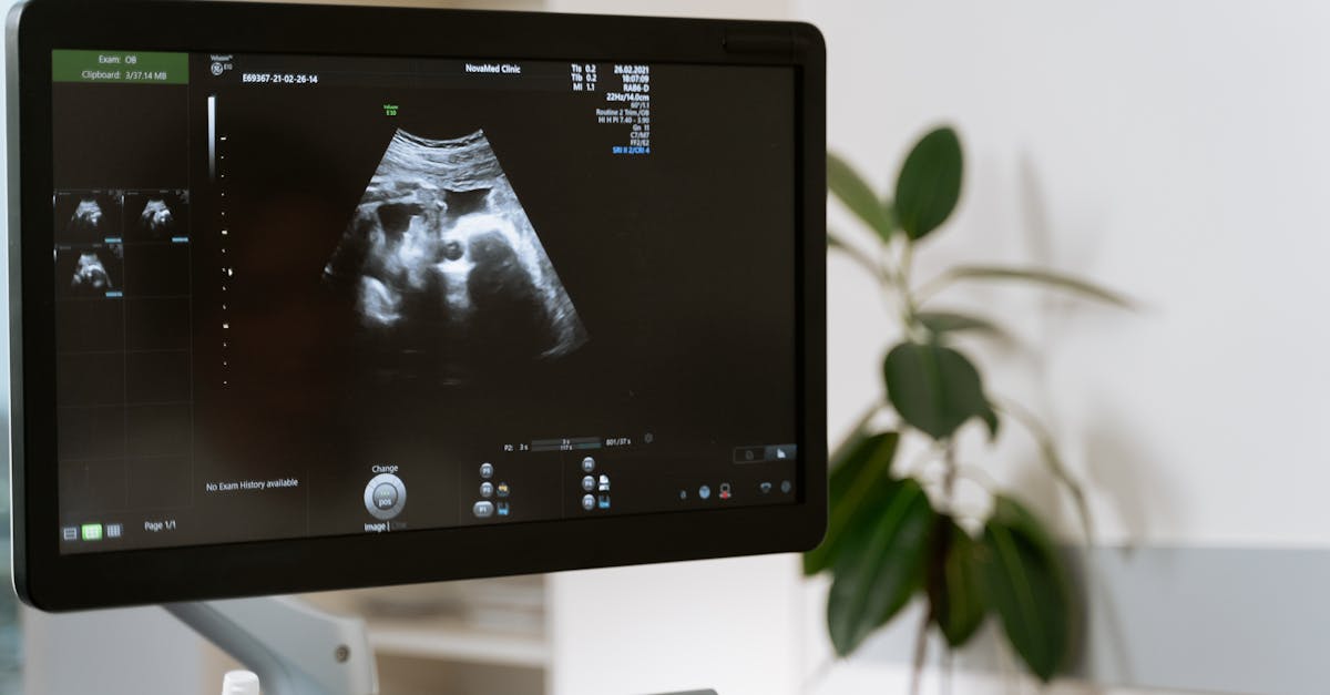 découvrez les étapes fascinantes du développement fœtal, de la conception à la naissance. apprenez comment un petit embryon se transforme en un bébé, tout en explorant les facteurs qui influencent cette période cruciale de la vie.