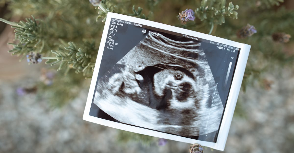 découvrez le développement fascinant du fœtus, de la conception à la naissance. explorez les étapes clés de la grossesse, les changements biologiques et les soins essentiels pour la future maman.