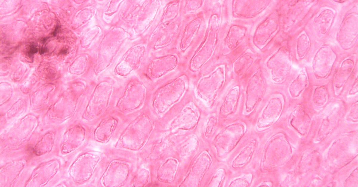 découvrez tout ce qu'il faut savoir sur la rupture de la membrane, ses causes, ses symptômes et les options de traitement. obtenez des conseils d'experts pour la gestion de cette condition et assurez-vous de votre bien-être.