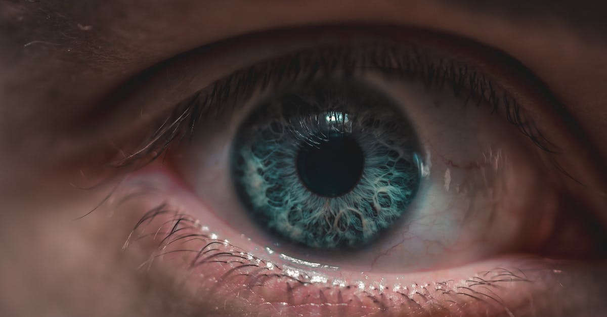 découvrez les changements oculaires, leurs causes et implications, ainsi que les conseils pour préserver votre santé visuelle. informez-vous sur les symptômes à surveiller et les traitements disponibles pour maintenir une bonne vision.