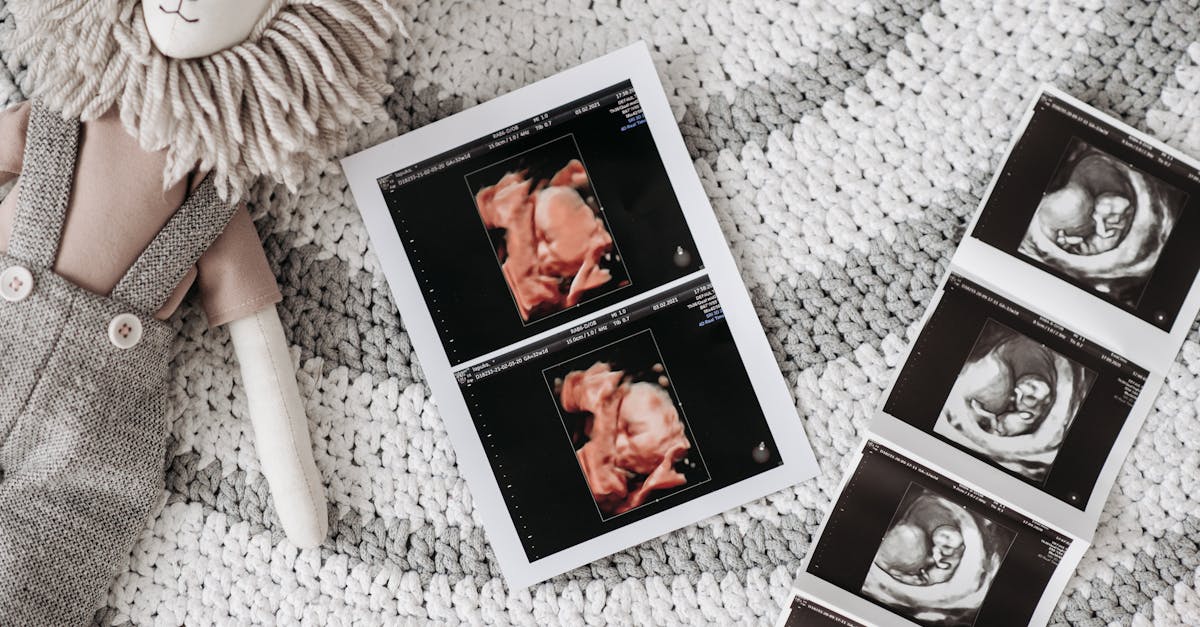 découvrez nos conseils essentiels pour une grossesse en pleine santé. apprenez à prendre soin de vous et de votre bébé grâce à des informations sur la nutrition, l'exercice, et le suivi médical. assurez-vous d'avoir une expérience de grossesse sereine et épanouissante.