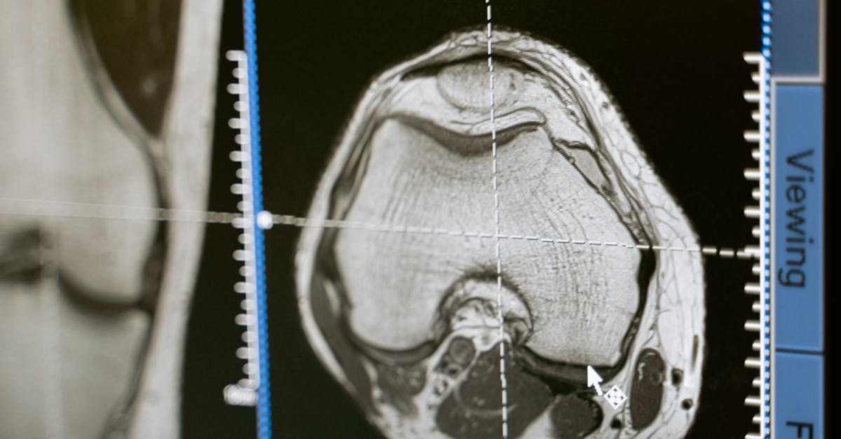 découvrez tout ce que vous devez savoir sur la radiation : ses types, ses effets sur la santé, et les mesures de protection à adopter. informez-vous sur la gestion des risques associés à la radiation dans divers domaines scientifiques et médicaux.