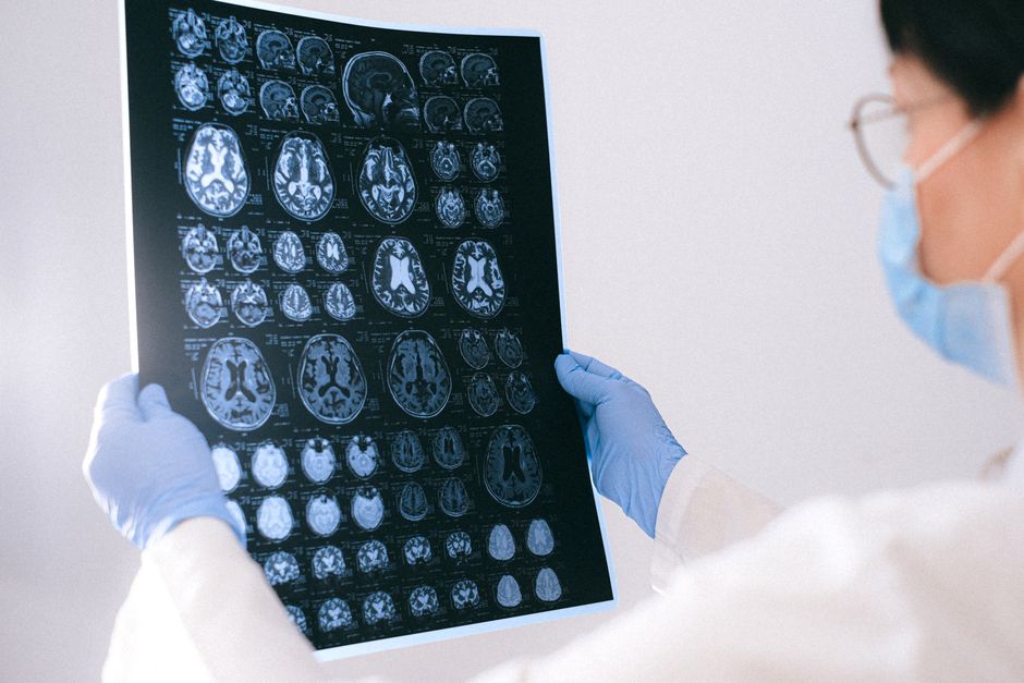 Amour romantique : 3 mythes sur le cerveau amoureux, sans bouton magique A medical professional reviewing MRI brain scans in a clinical setting, highlighting healthcare technology.